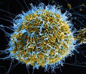 Colorized scanning electron micrograph of filamentous Ebola virus particles (blue).  Credit: National Institute of Allergy and Infectious Diseases.